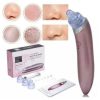 EXTRACTOR DE PUNTOS NEGROS