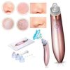 EXTRACTOR DE PUNTOS NEGROS