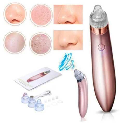 EXTRACTOR DE PUNTOS NEGROS